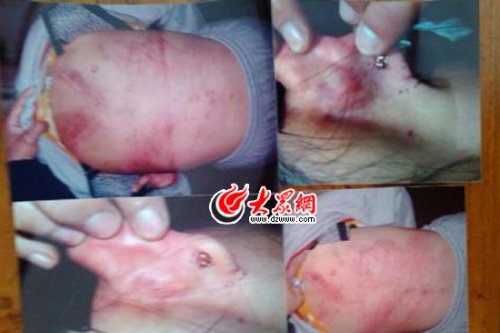 　山東藝術(shù)設(shè)計學(xué)院16歲女生宿舍內(nèi)被女同學(xué)暴打4小時。