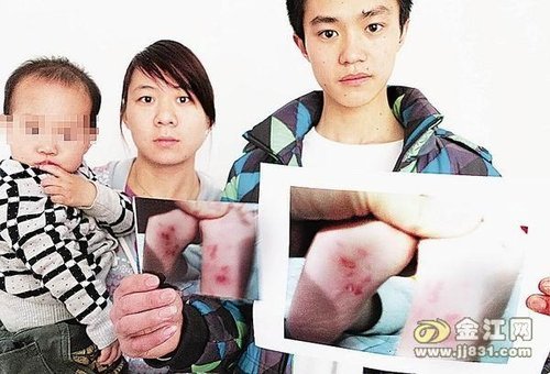 老師嫌2歲小孩哭鬧 將其腳板掐出20余道傷痕 老師嫌2歲小孩哭鬧 將其腳板掐出20余道傷痕