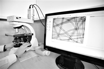 顯微鏡下，聚酯纖維很光亮，表面有斑點(diǎn)，粗細(xì)非常均勻。