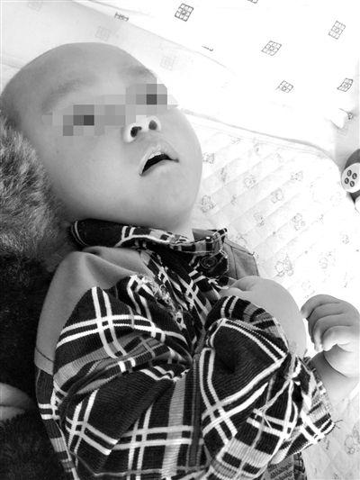 9月10日，陳揚(yáng)躺在醫(yī)院的病床上，他的眼睛仍然沒有聚焦感。新京報(bào)記者 朱柳笛 攝