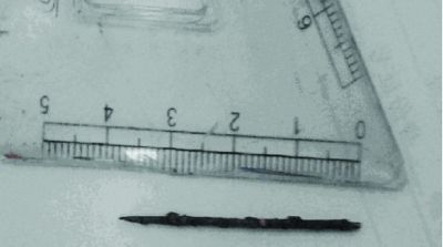 取出的繡花針已發(fā)黑生銹。