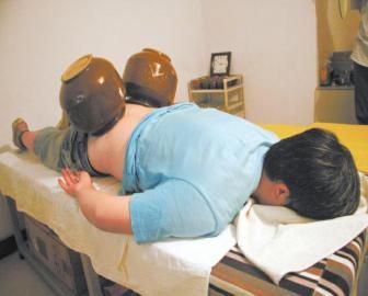 拔泡菜壇子火罐。