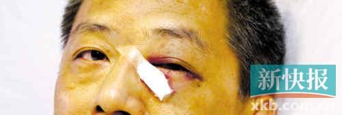 ■這起醫(yī)鬧事件，受傷的遠(yuǎn)遠(yuǎn)不只是熊旭明醫(yī)生的身體。