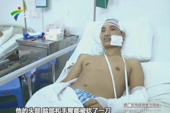 另一名傷者頭部、臉部和手臂都被砍了一刀。(視頻截圖)