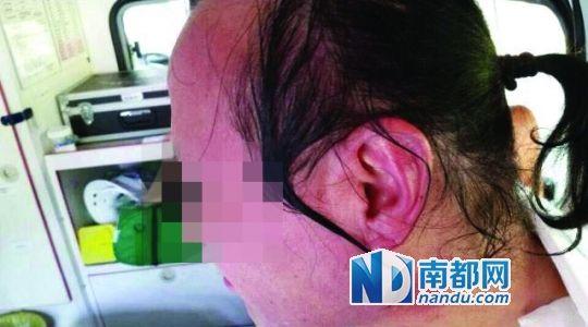 涉事教師遭熱水潑臉后的照片。