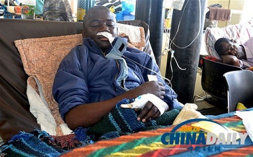 雖然已經(jīng)在醫(yī)院接受了近一個(gè)月的恢復(fù)治療，卡托卡的身體仍然非常虛弱。