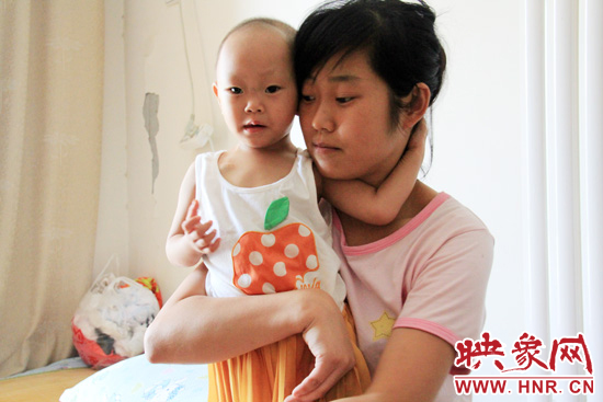 孩子和媽媽在一起，她的右眼已經(jīng)失明。