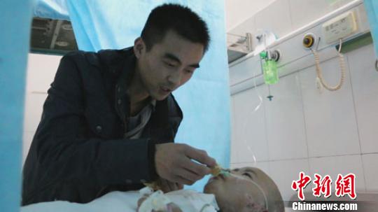 河南掉油鍋重傷女童4次植皮已轉出重癥監(jiān)護室