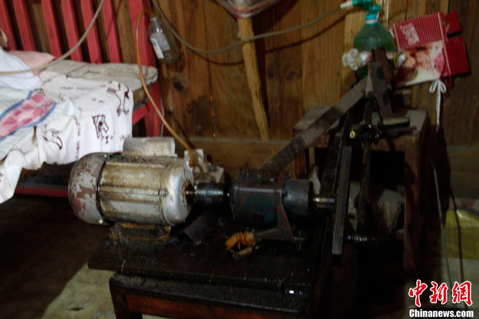 父母為癱瘓兒子自制呼吸機 手捏呼吸球5年不輟