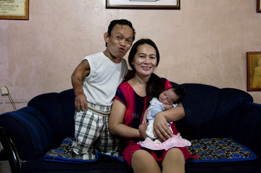 侏儒癥患者的艱辛生活 侏儒癥患者的艱辛生活