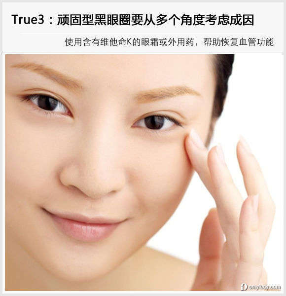頑固型黑眼圈要從多個(gè)角度考慮成因 頑固型黑眼圈要從多個(gè)角度考慮成因
