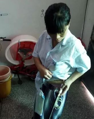 女子路上被撞200元私了 隔天病危入院1個(gè)月花掉7萬(wàn)