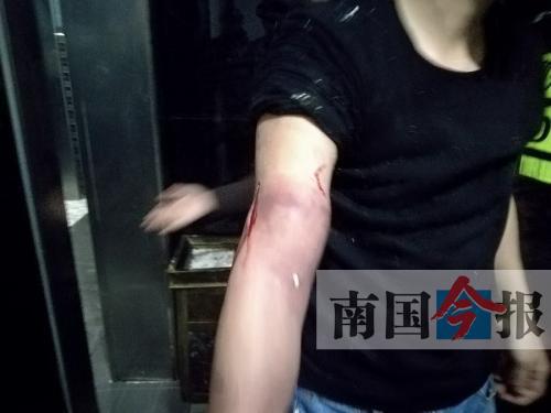 覃先生手臂被卡的部位受傷流血，所幸傷勢無大礙。 通訊員 王建民 攝