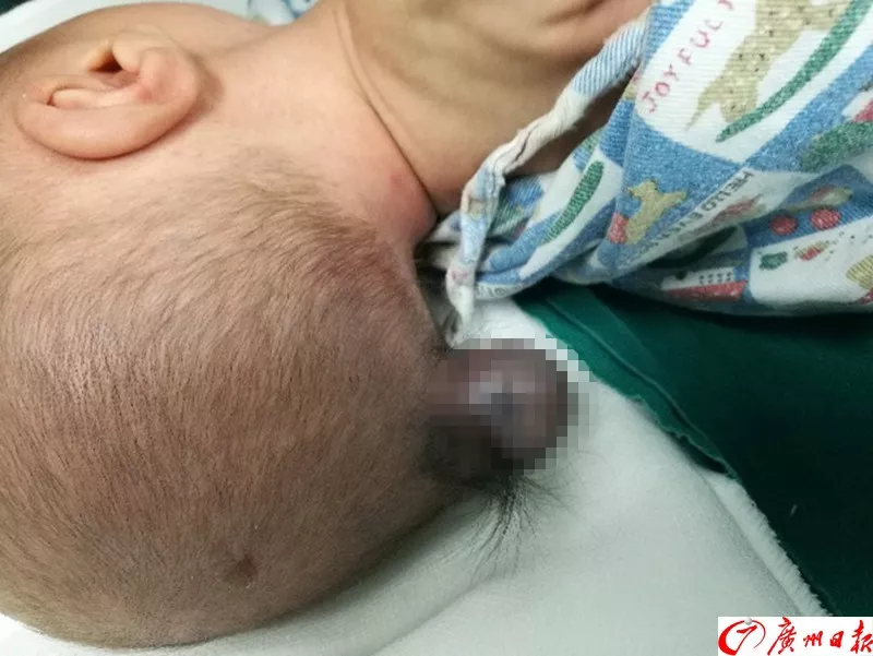 剛出生的男嬰腦袋上長(zhǎng)出尾巴 只因孕媽沒做這事