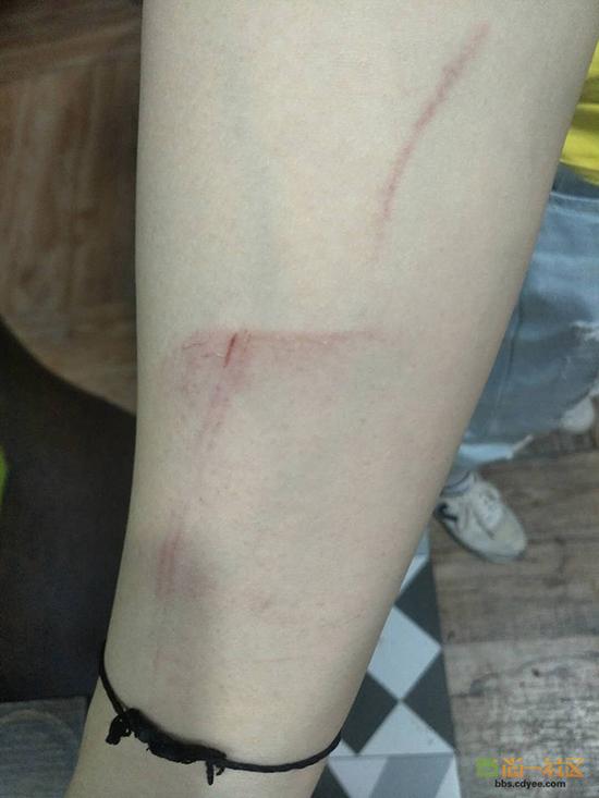 女網(wǎng)友舉報(bào)網(wǎng)帖中出示的被打后照片。
