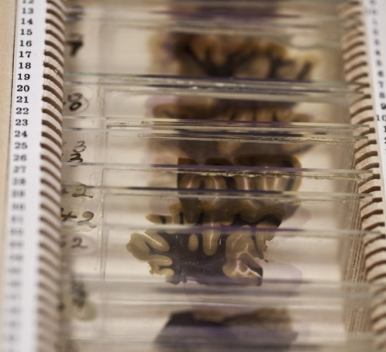 愛因斯坦大腦切片 愛因斯坦大腦切片