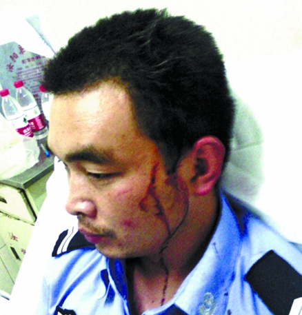 汝陽(yáng)協(xié)警遭賭徒暴力抗法并圍毆 公安局稱這是內(nèi)部的事 汝陽(yáng)協(xié)警遭賭徒暴力抗法并圍毆 公安局稱這是內(nèi)部的事