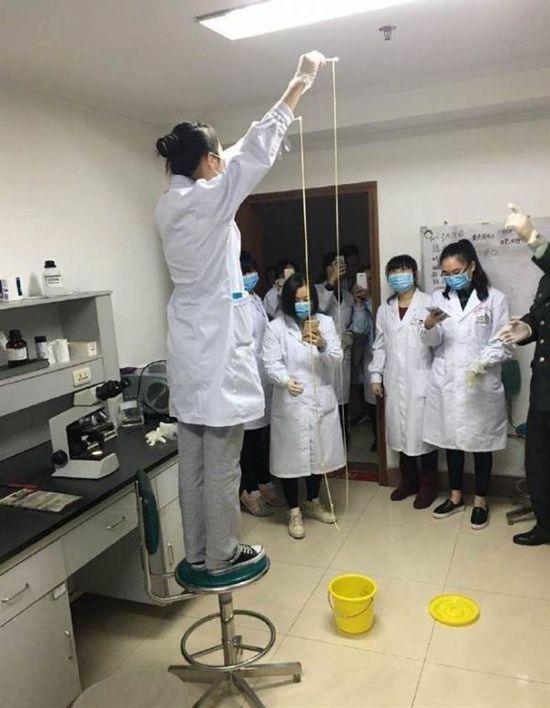 愛吃生肉惹的禍！男子體內(nèi)取出5米長寄生蟲(圖)