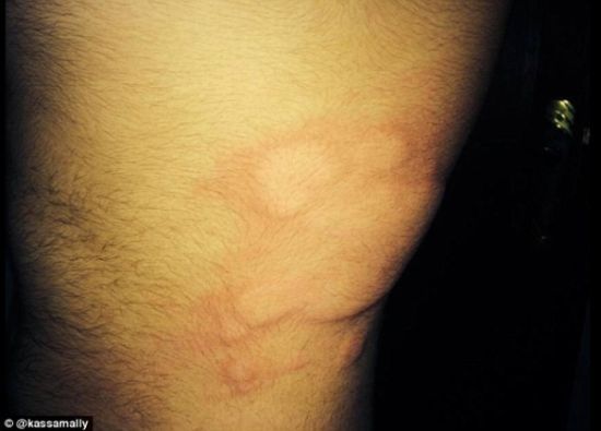 IS被指在敘利亞使用化學武器 有居民失明起水泡