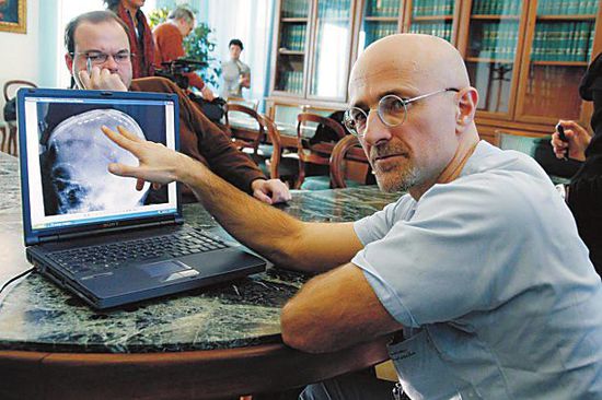 圖為卡納維洛醫(yī)生，不少人認(rèn)為他的想法非常瘋狂