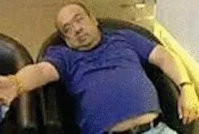 網(wǎng)傳金正男中毒后的照片。