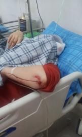 砸窗當事人胡女士在醫(yī)院接受治療。