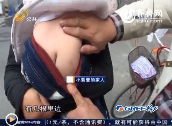 女?huà)塍w內(nèi)現(xiàn)16根鋼針無(wú)法取出 父母懷疑被下黑手