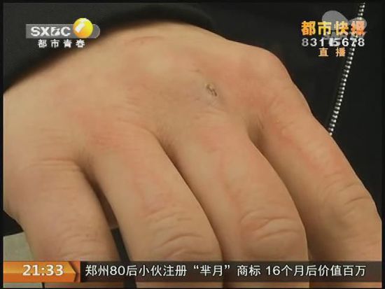 說(shuō)到這足療拔罐，估計(jì)大伙都不陌生，但是想起4號(hào)晚上的拔罐的經(jīng)歷，呂先生現(xiàn)在想起來(lái)，還心有余悸。