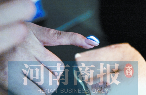 將指甲油涂在指甲上，靠近火焰時(shí)被引燃了