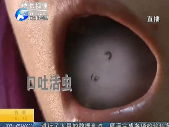 女子喝口水 要吐十條蟲(chóng)